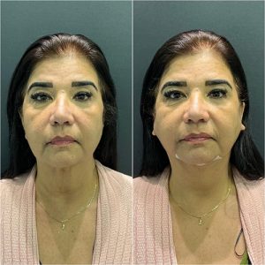 WhatsApp Image 2024-11-08 at 11.04.20