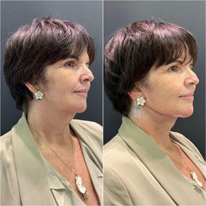 WhatsApp Image 2024-11-08 at 11.04.39