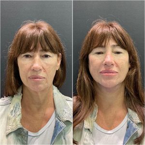 WhatsApp Image 2024-11-08 at 11.04.42