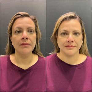 WhatsApp Image 2024-11-08 at 11.04.45