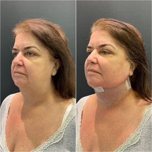 WhatsApp Image 2024-11-08 at 11.04.48 (2)